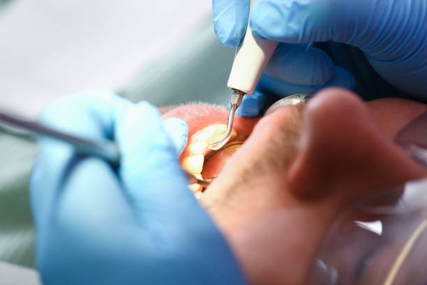 Best Emergency Care for Gum Disease in Oak Brook, IL